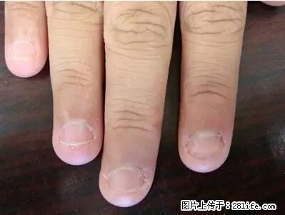 剪指甲、挖耳屎,这些日常小动作竟隐藏大危害! - 庆阳生活资讯 - 庆阳28生活网 qingyang.28life.com
